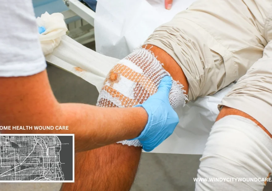 Home health wound care education 2