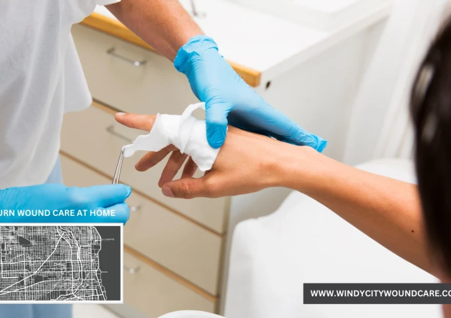 Burn Wound Care at Home