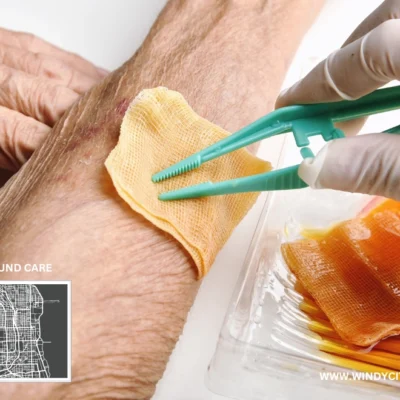 wet to dry wound care how to