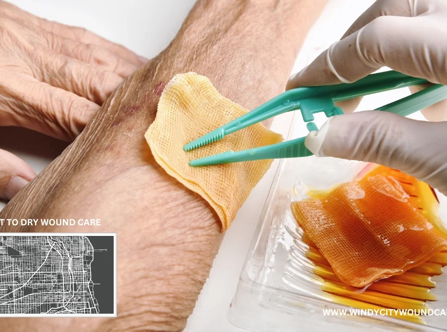 wet to dry wound care how to