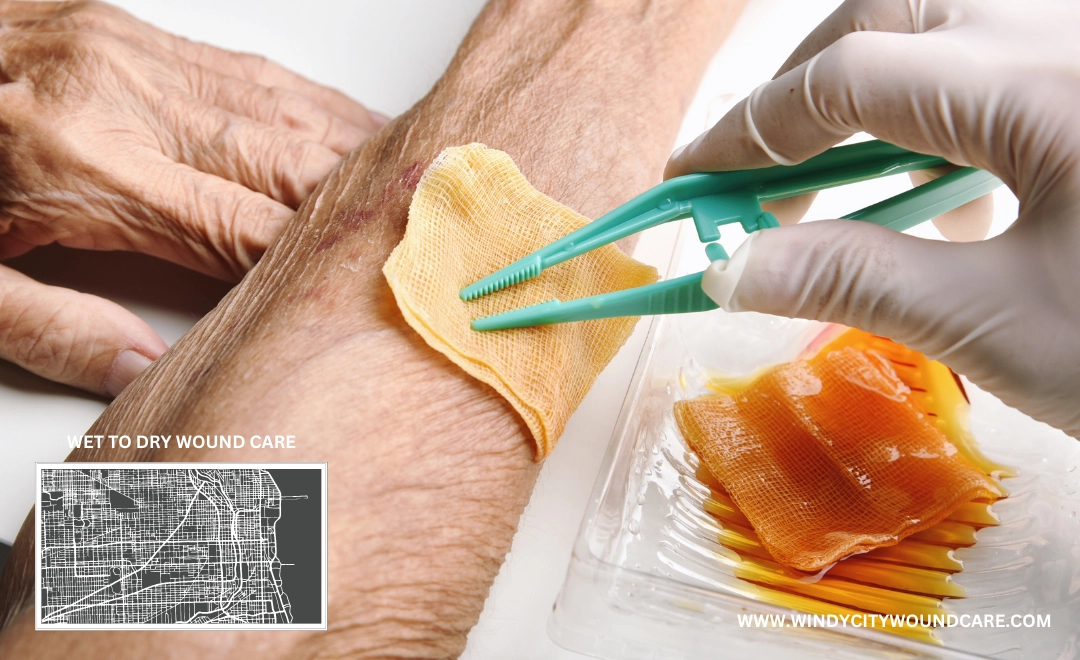 wet to dry wound care how to